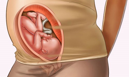 u xơ tử cung ảnh hưởng gì đến thai nhi